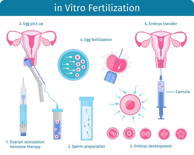 An analysis of the process of fertilization in female body